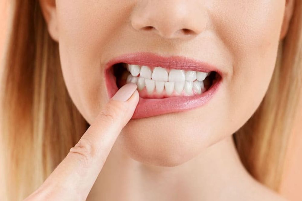 What Is Enamel Erosion and How Does It Affect Your Teeth?